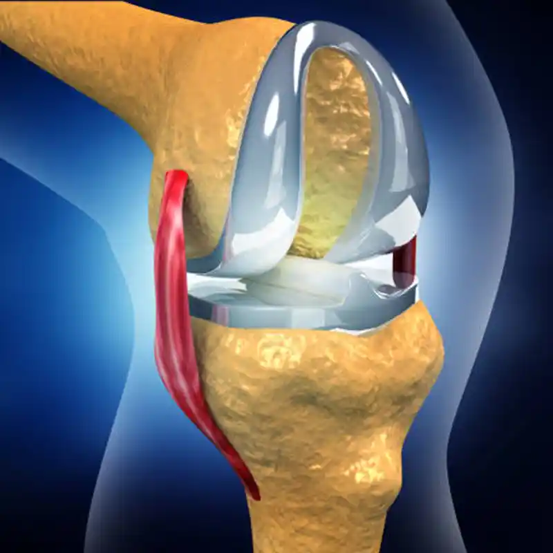 reemplazo-articular-de-rodilla-dr-christian-rodriguez